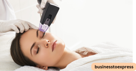 Morpheus8 and Its Impact on Collagen Production
